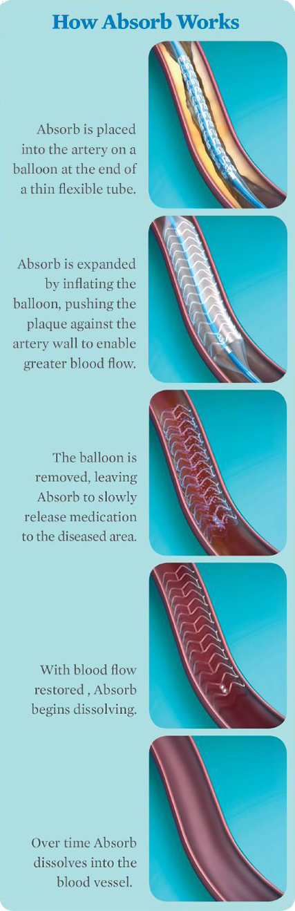 How Absorb Works Illustration