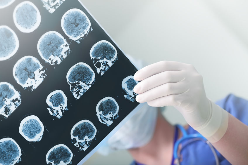 Neurosurgical conditions and diseases